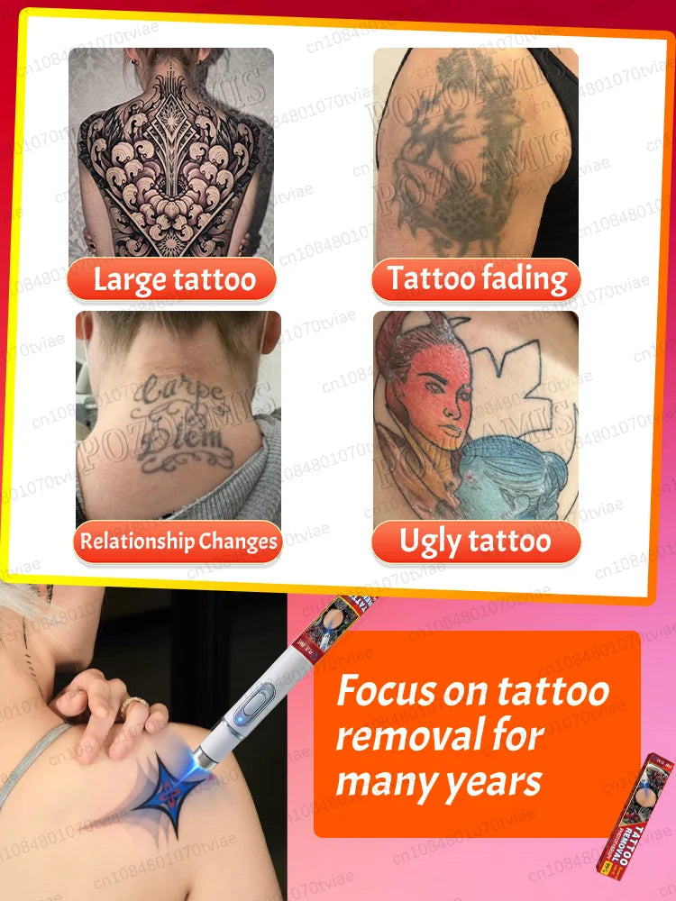 Tattoo Removal Laser Pen, suitable for tattoos of all sizes, effectively removes permanent tattoos. Innova Techno