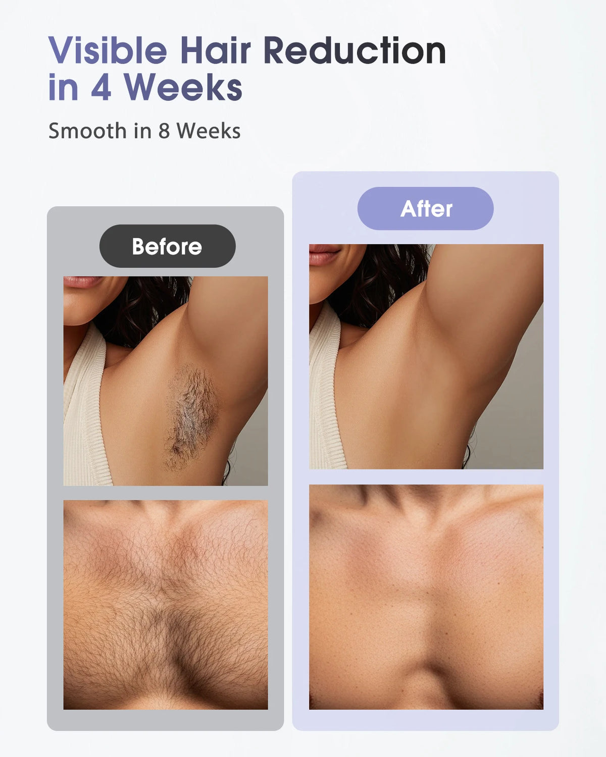 IPL Laser Hair Removal Device for Women & Men - Safe At-Home 45°F Ice-Cooling Contact for Painless & Long-Lasting Results, 86% Less Hair In 3 Weeks for Full Body & Face