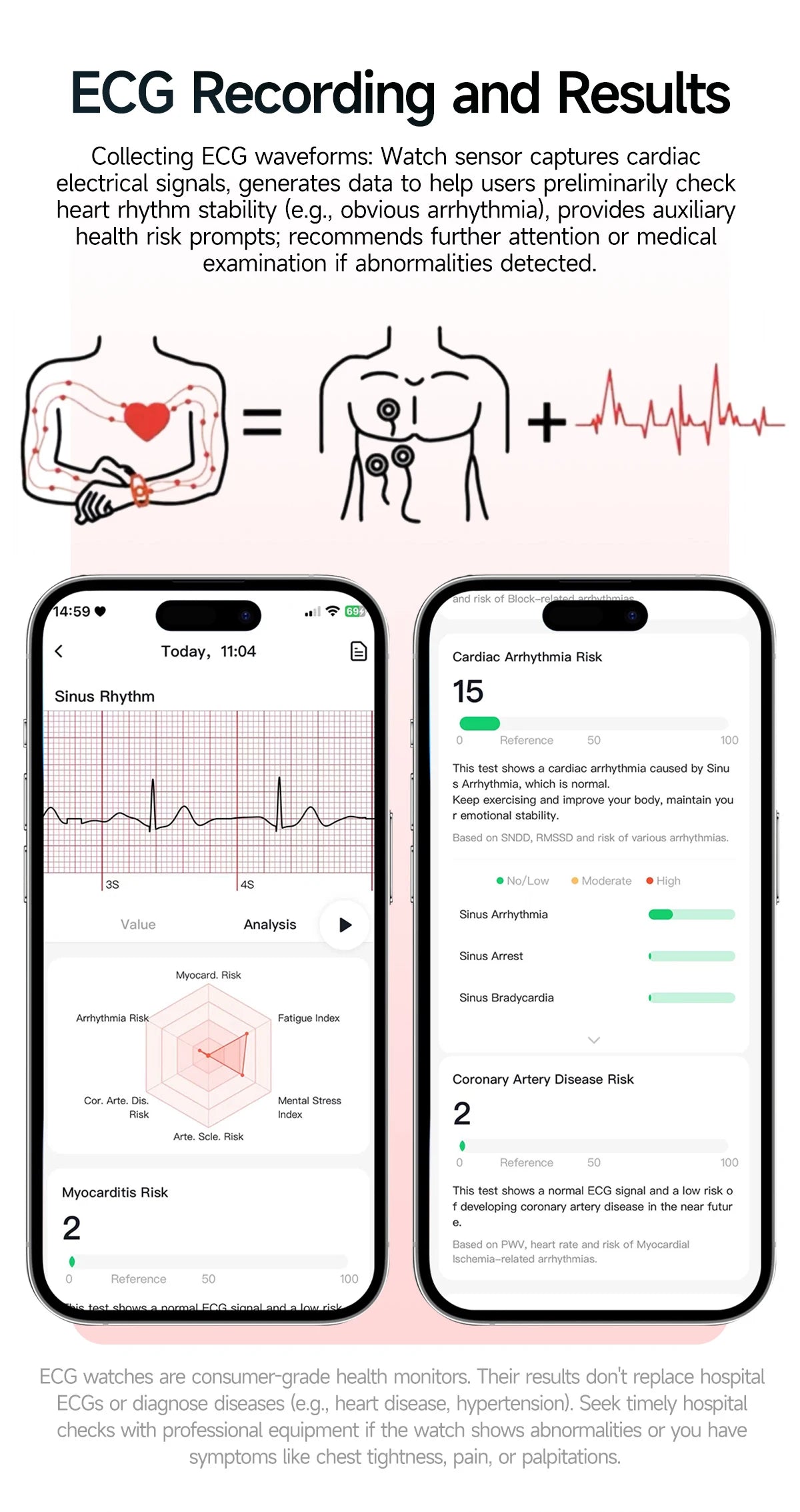 2026 New ECG+PPG Smart Healthy Diagnosis Surveillance Body Analysis Blood Pressure Lipid Uric Acid Health Smart Watches For Men