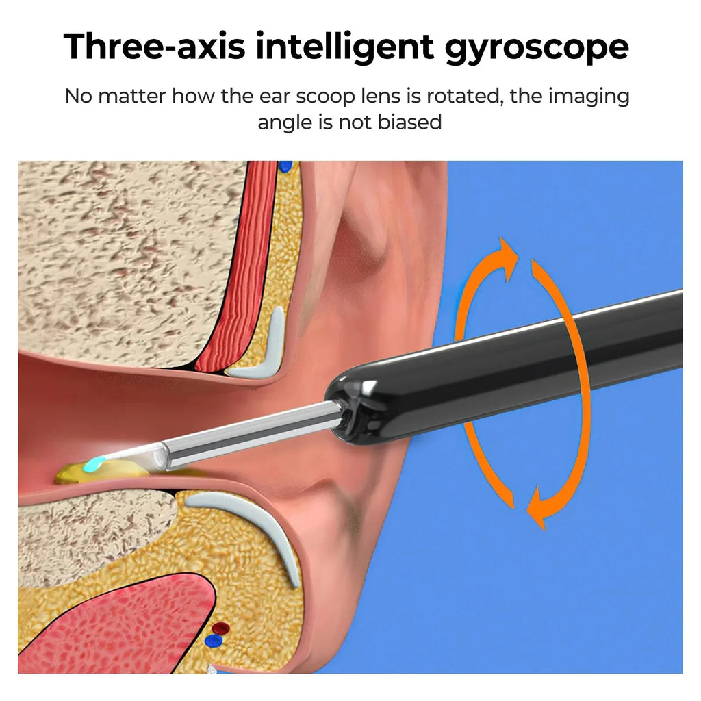 Wireless Smart Visual Ear Cleaner 800W Ear Stick Otoscope  Ear Wax Removal Tool Ear pick Camera Ear Endoscope for iOS Android Innova Techno