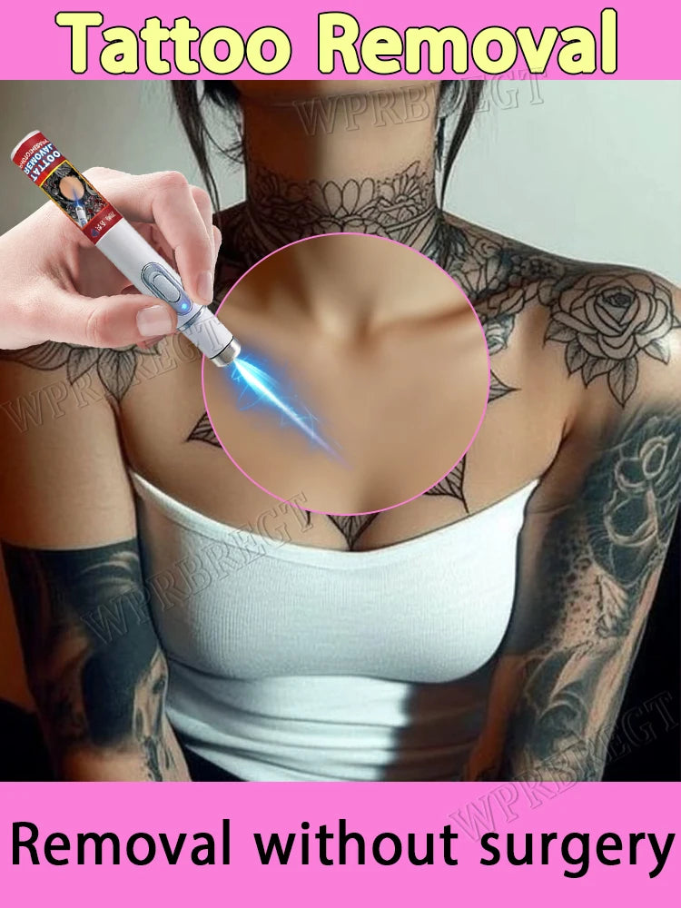Tattoo Removal Laser Pen, suitable for tattoos of all sizes, effectively removes permanent tattoos. Innova Techno