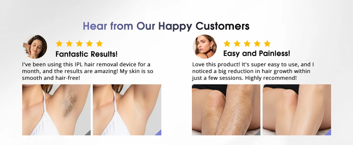 IPL Laser Hair Removal Device for Women & Men - Safe At-Home 45°F Ice-Cooling Contact for Painless & Long-Lasting Results, 86% Less Hair In 3 Weeks for Full Body & Face