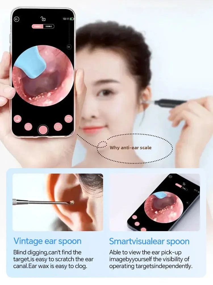 Generation-2,Visual Ear Wax Cleaner Camera Safe Earwax Removal Endoscope Ear Cleaning Tools Ear Care,Black,white styles,Hot sale Innova Techno