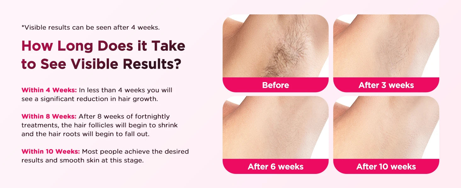 990000 Flash Laser Epilator IPL Hair Removal For Men and Women Body Bikini Facial  Permanant Painless IPL Hair Remover Machine Innova Techno