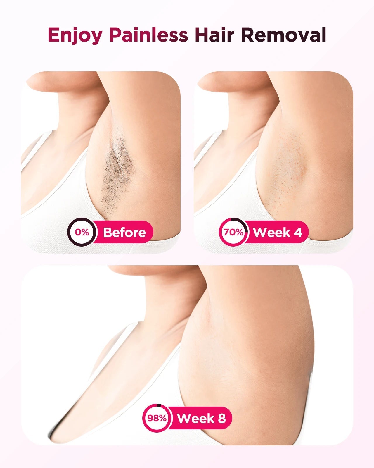 990000 Flash Laser Epilator IPL Hair Removal For Men and Women Body Bikini Facial  Permanant Painless IPL Hair Remover Machine Innova Techno